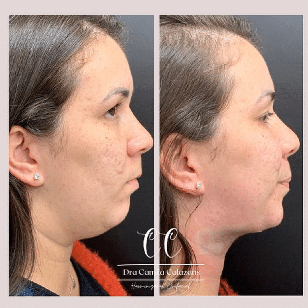 Expert em Rejuvenescimento e Embelezamento Facial no Rio de Janeiro - Dra.  Camila Calazans